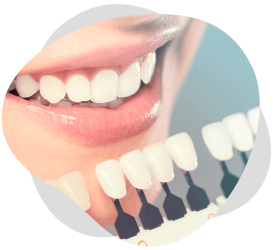 odontologia-estetica-na-max